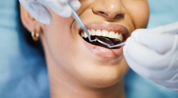 Best Emergency Dental Care for Broken or Chipped Teeth in Amite City, LA